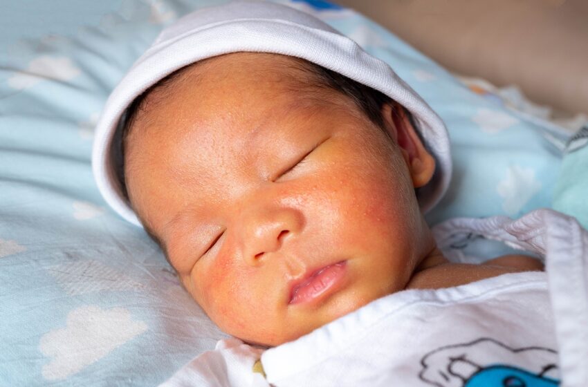  What causes high bilirubin in babies?