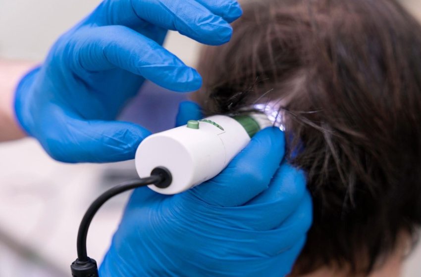  7 Ways to Treat Oily Scalp at an Orchard Hair Salon in Singapore